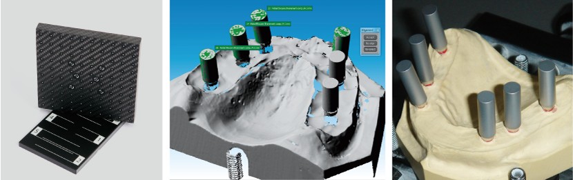 ImetricDentalScanner