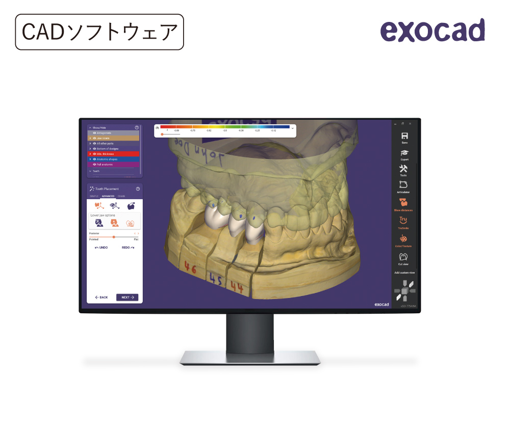 DentalCAD